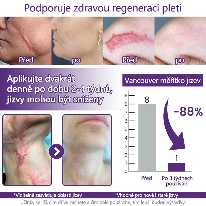 Regen Scar Repair Gel