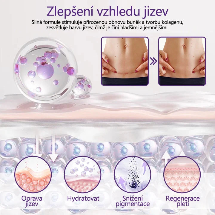 Regen Scar Repair Gel