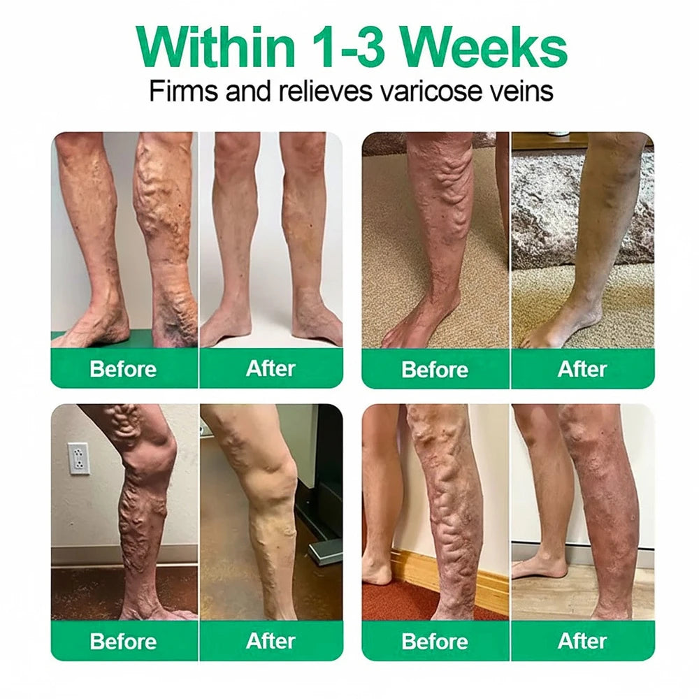 VeinEase Overnight Therapy Patch