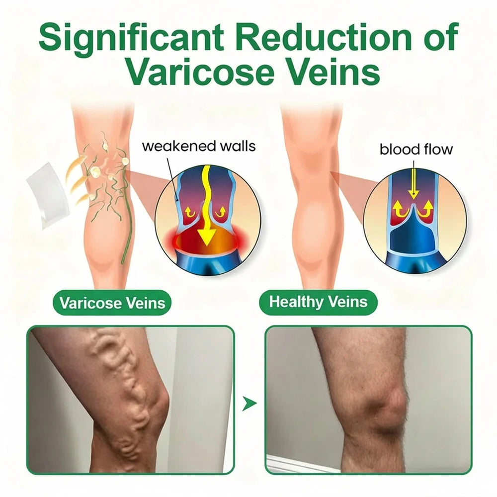 VeinEase Overnight Therapy Patch