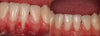 Biancat BeeTakt Oral Repair Solution