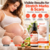 SilkStretch Body Care Oil