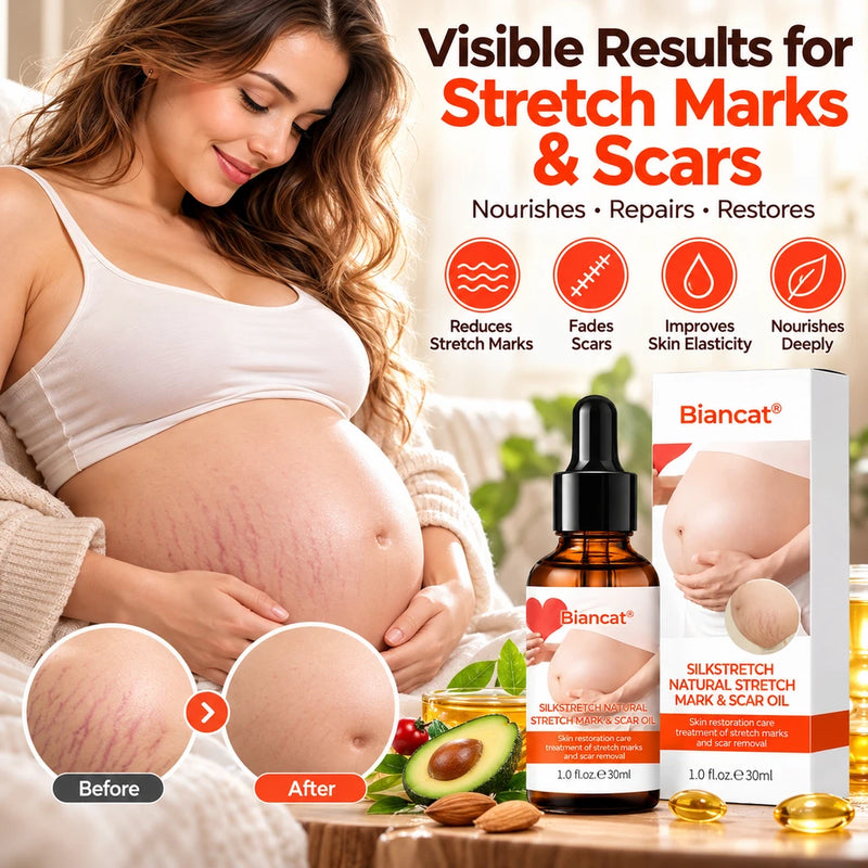 SilkStretch Body Care Oil