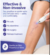 Portable Spider Vein Removal Pen