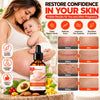 SilkStretch Body Care Oil