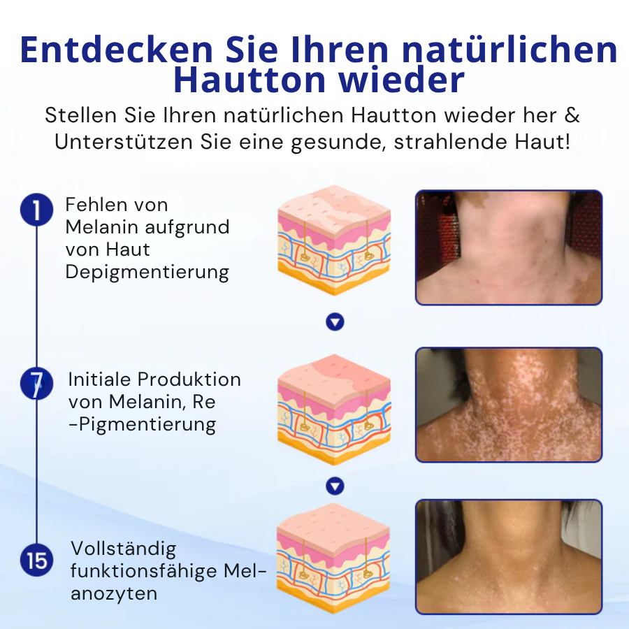 Skin Restore Spray